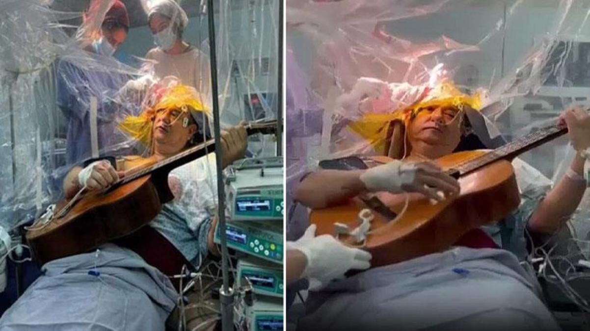 55 yaşındaki müzik öğretmeni beyin ameliyatı olurken 4 saat boyunca gitar çaldı