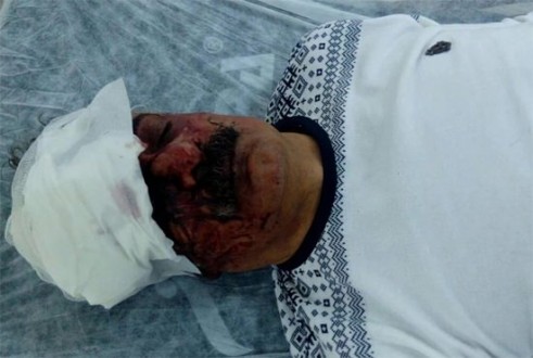 İşte PKK'nın Gerçek Yuzu: Çiyager'i Öldüresiye Dövdüler