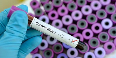 Corana Virüs Tedavisi Bulundu mu? O Ülkeden Büyük İddia Virüsü Yok Ettik