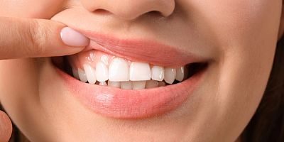 Japon bilim insanları dişlerin uzamasına ve yeniden çıkmasına yardımcı bir ilaç geliştirdi