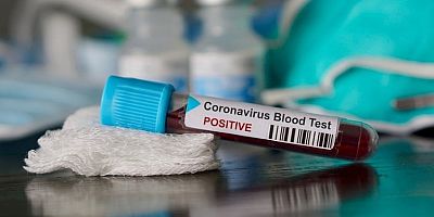koronavirüse karşı yeni bir tedavi geliştirdi